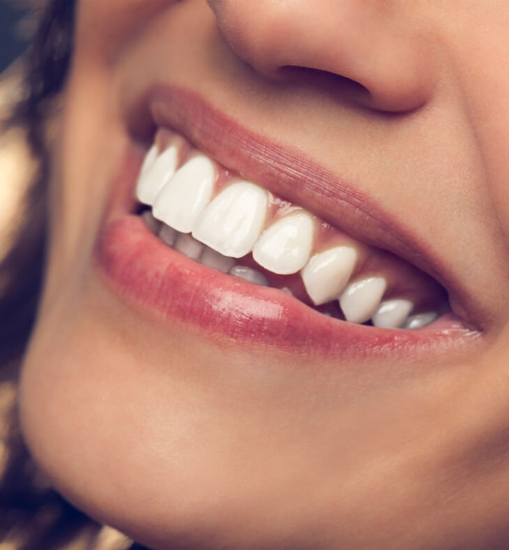 Healthy white smile close up