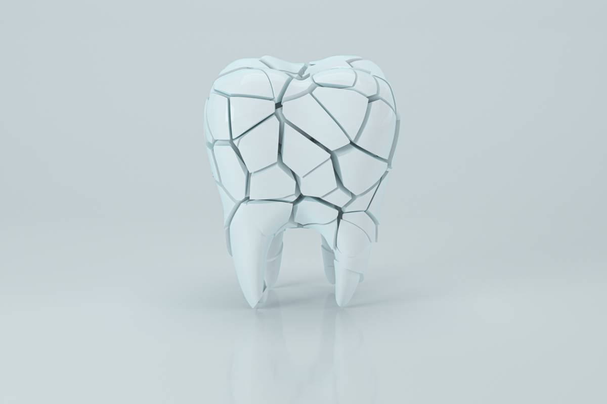 Concept of a cracked tooth
