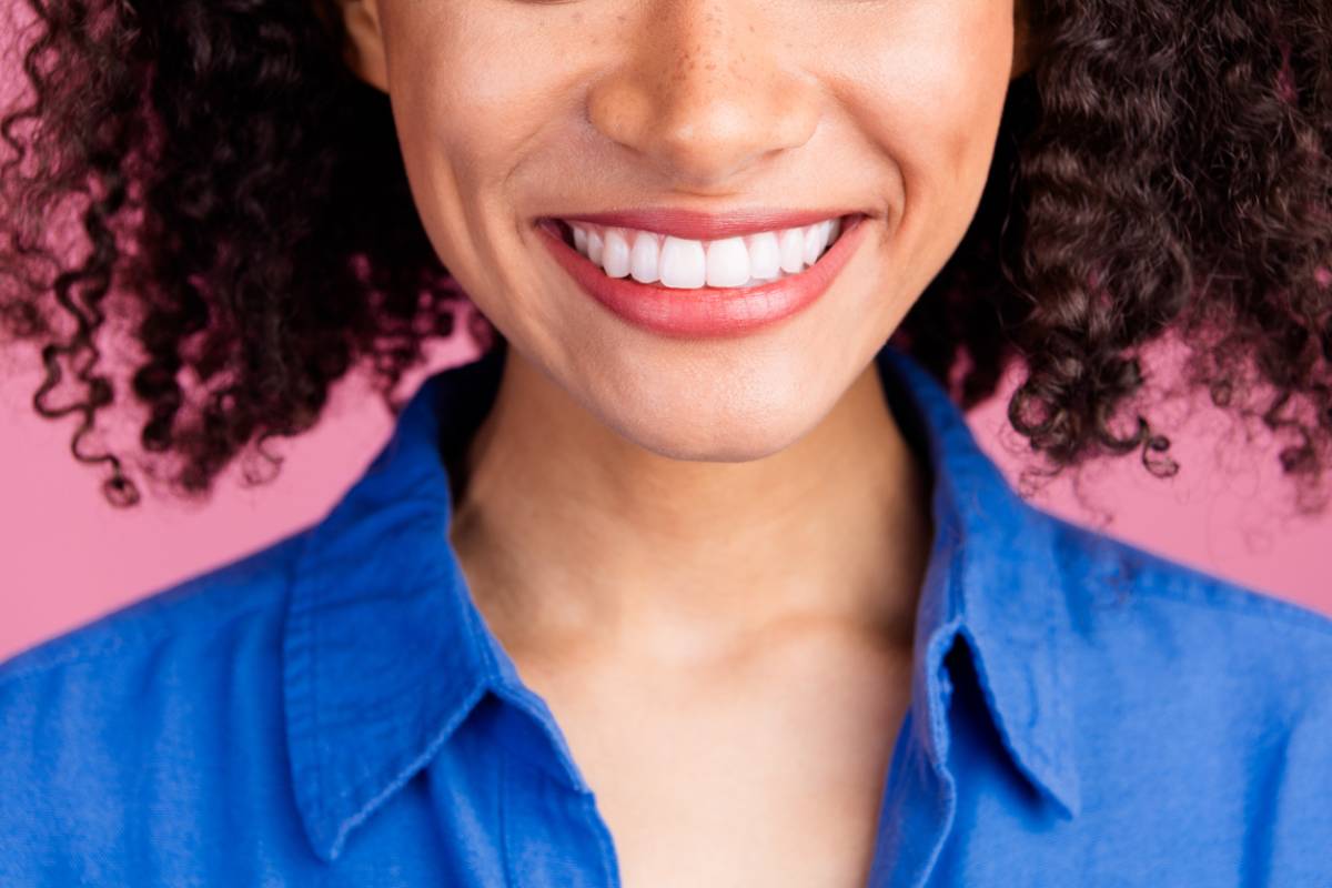 Featured image for How Long Do Veneers Last?