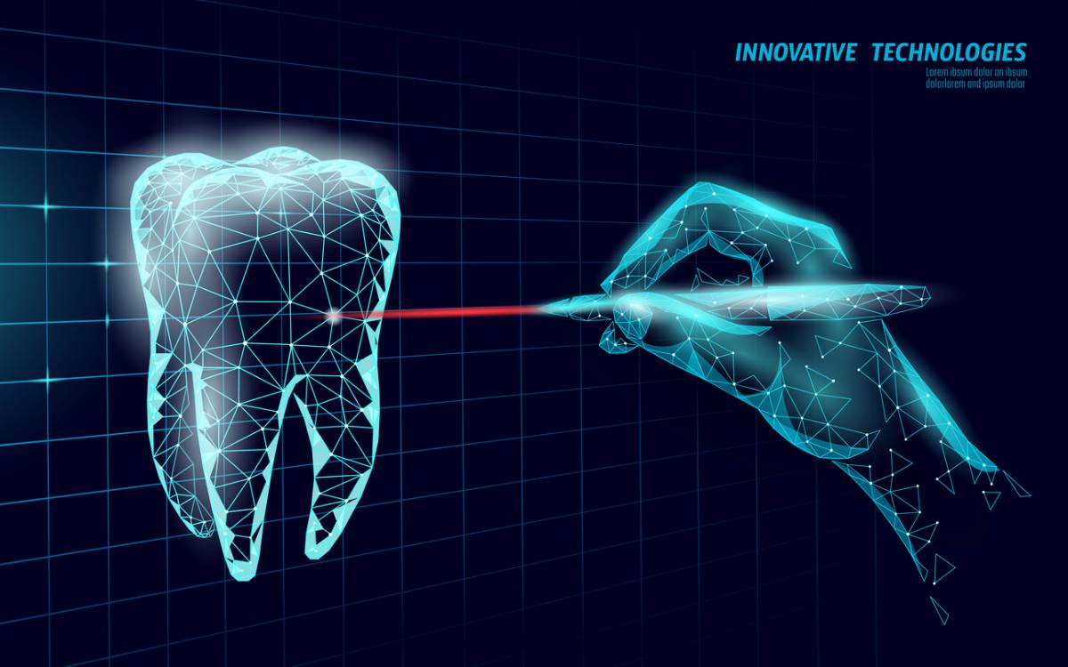 featured image for how root canals utilize laser tech